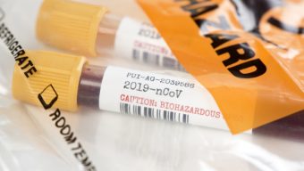 Coronavirus : des chiffres encourageants en Pays de la Loire